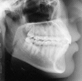 Radiologia Odontológica em Paulista - PE